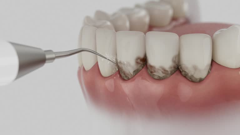 Trusted Teeth Cleaning And Checkup service in Coulee Dam, WA - Dentist Open Now